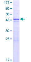 12.5% SDS-PAGE Stained with Coomassie Blue.